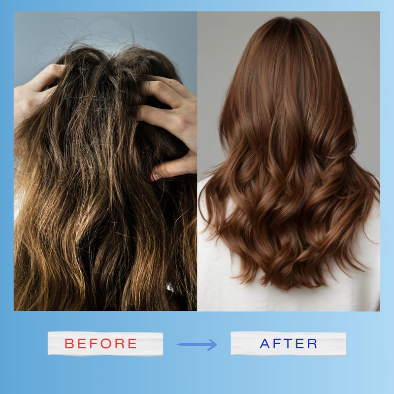 Mediceuticals X-Derma Dry Scalp & Hair Treatment Shampoo -Size: 8.45 oz/250 ml - Image 5